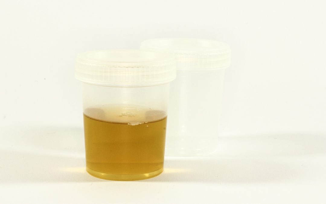 Drug Testing Employees