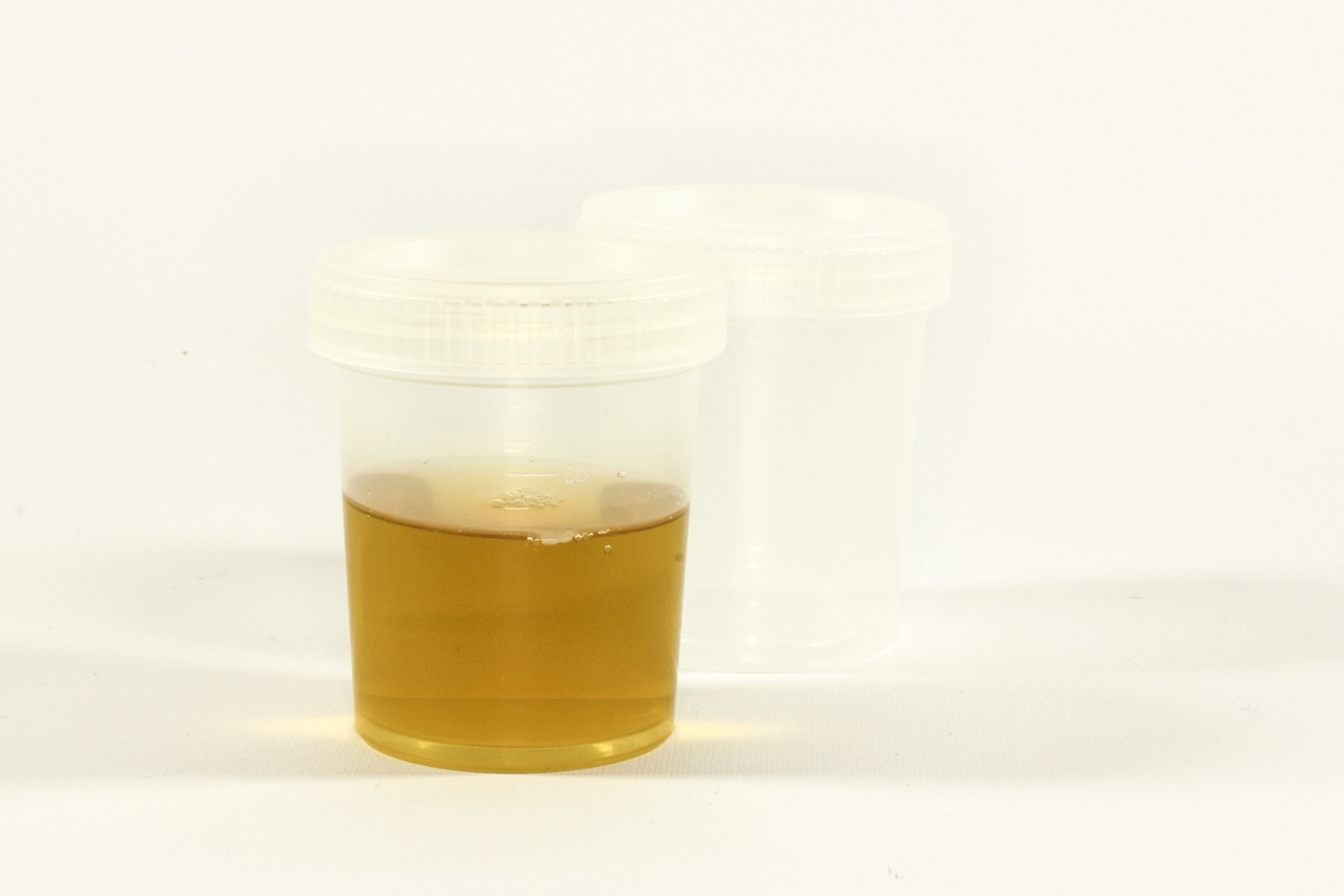 drug testing